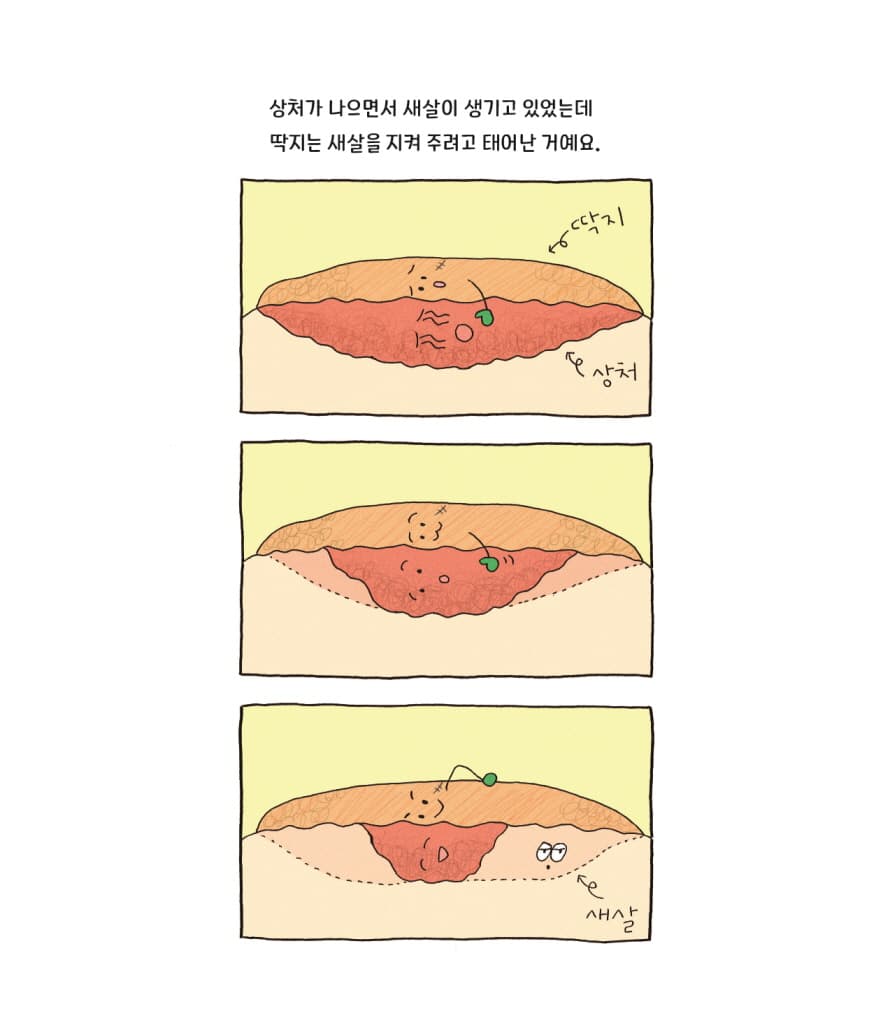 새살이 솔솔 자연 반창고 딱지